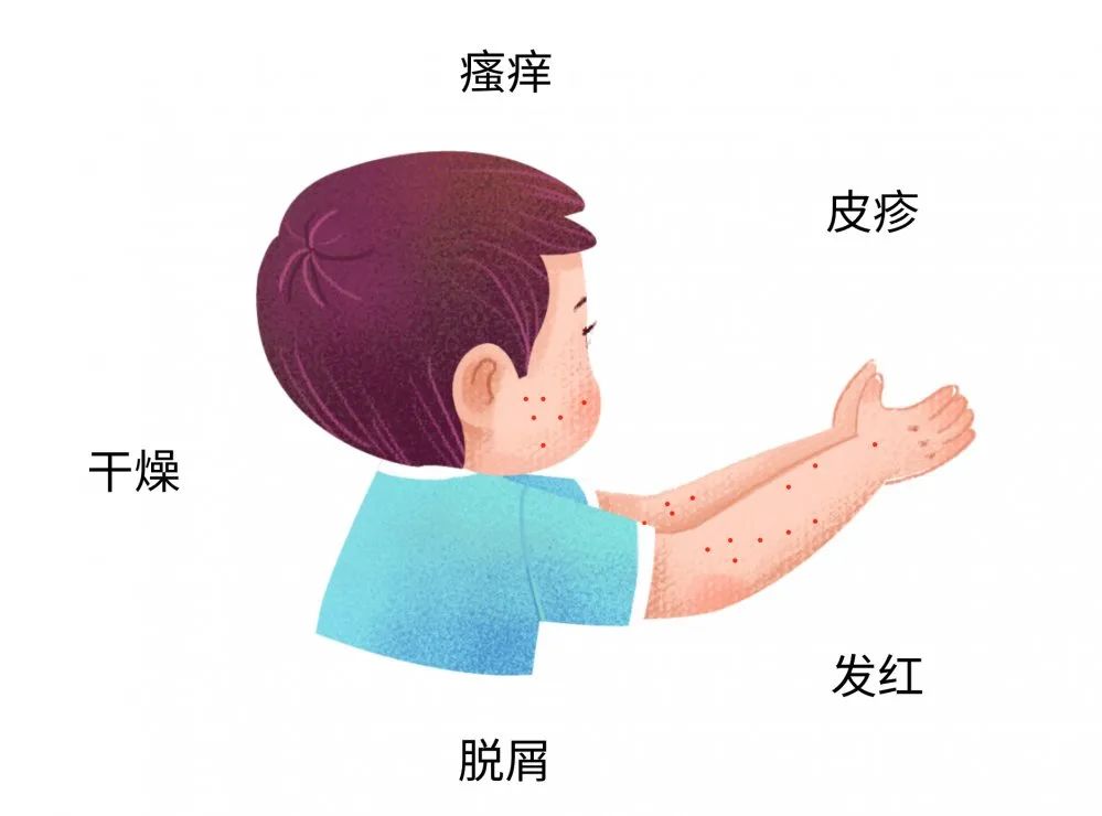 這些癥狀都可能是寶寶過敏傳遞的信號，很多寶媽還不知道